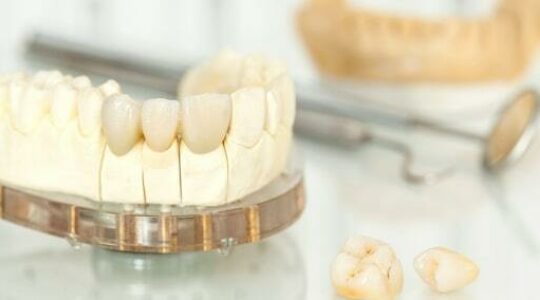 dental-crowns-1.jpg