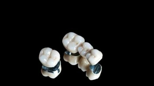 dental-crowns-3.jpg