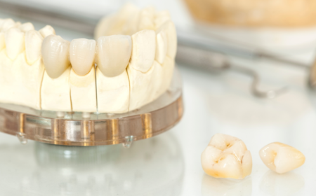 Dental-Crowns-header-image.png