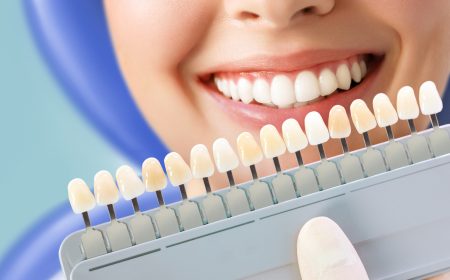 smiling-young-woman-cosmetological-teeth-whitening-dental-clinic-selection-tone-implant-tooth.jpg